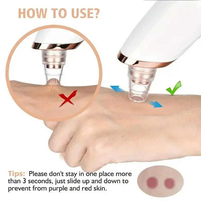 Nettoyant facial à 5 embouts pour points noirs et pores