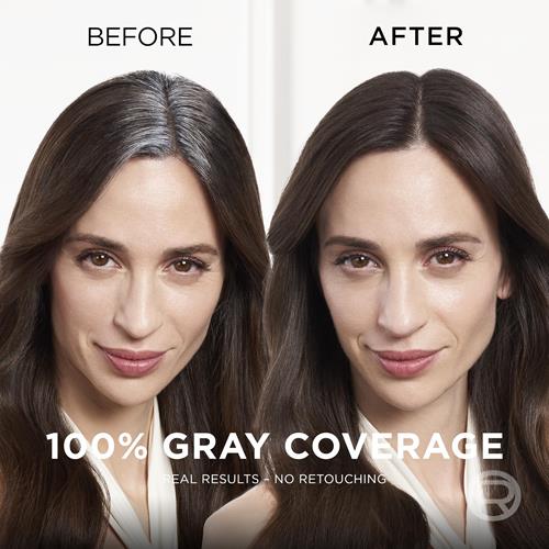 L'Oréal Paris Magic Root Cover Up Vaporisateur anti-repousse, brun moyen, 57 g (l'emballage peut varier)