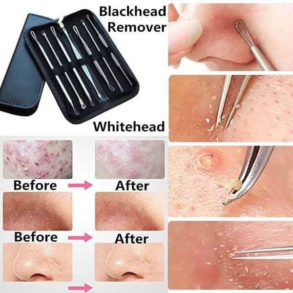 Lot de 8 : Kit de soins professionnels pour la peau
