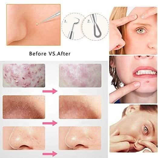 Lot de 8 : Kit de soins professionnels pour la peau