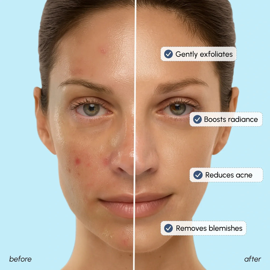 Tonique éclat à l'acide glycolique