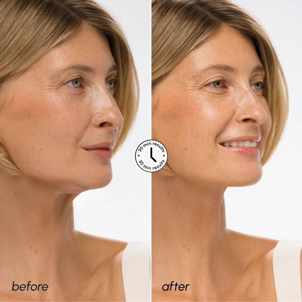 Masque liftant acide hyaluronique en V