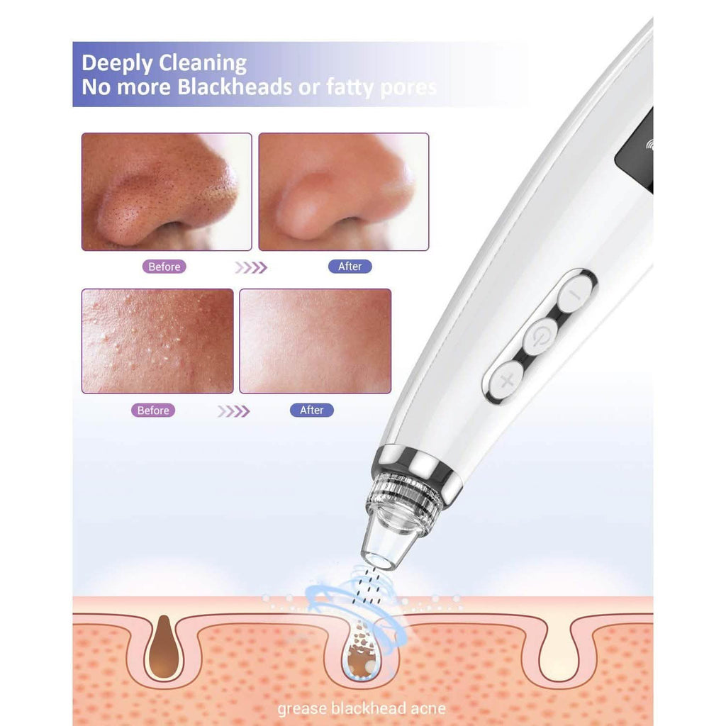 Extracteur de points noirs et nettoyeur de pores