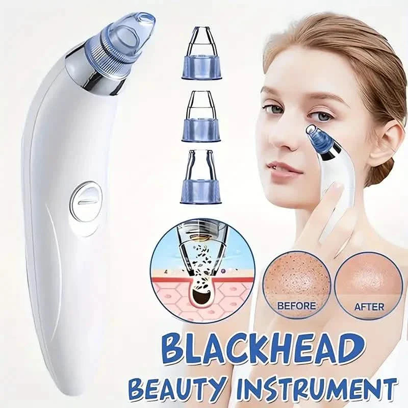 Extracteur de points noirs, puissant nettoyeur de pores portable avec 4 sondes