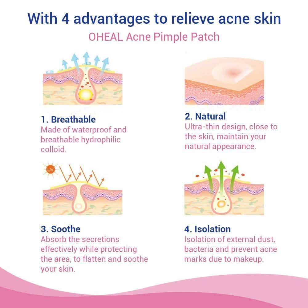 Patchs de traitement localisé des imperfections et de l'acné cicatrisants pour la peau