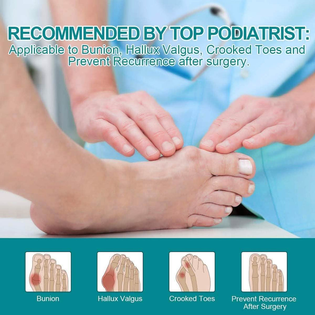 Correcteur d'oignon, redresseur d'hallux valgus, soulagement de la douleur