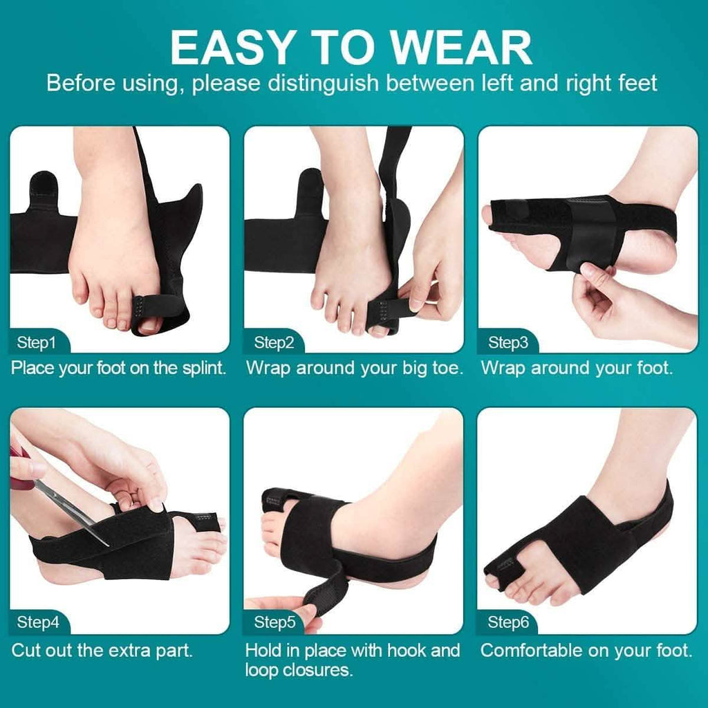Correcteur d'oignon, redresseur d'hallux valgus, soulagement de la douleur