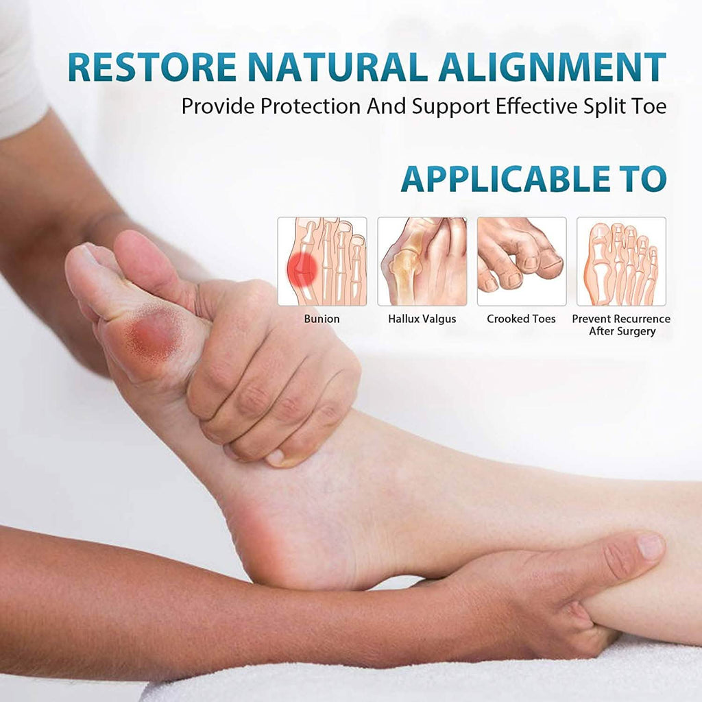 Correcteur d'oignon, redresseur d'hallux valgus, soulagement de la douleur