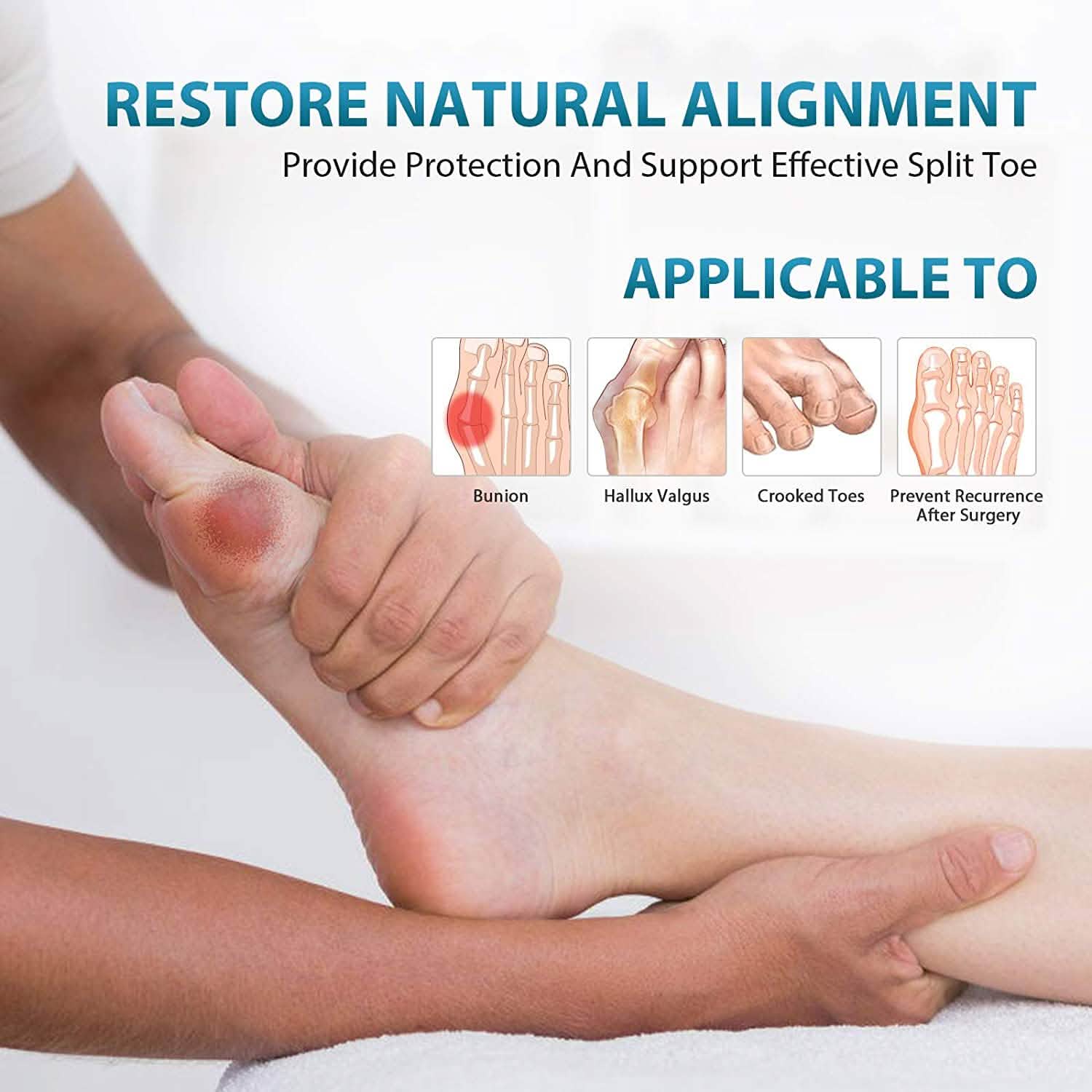 Correcteur d'oignon, redresseur d'hallux valgus, soulagement de la douleur