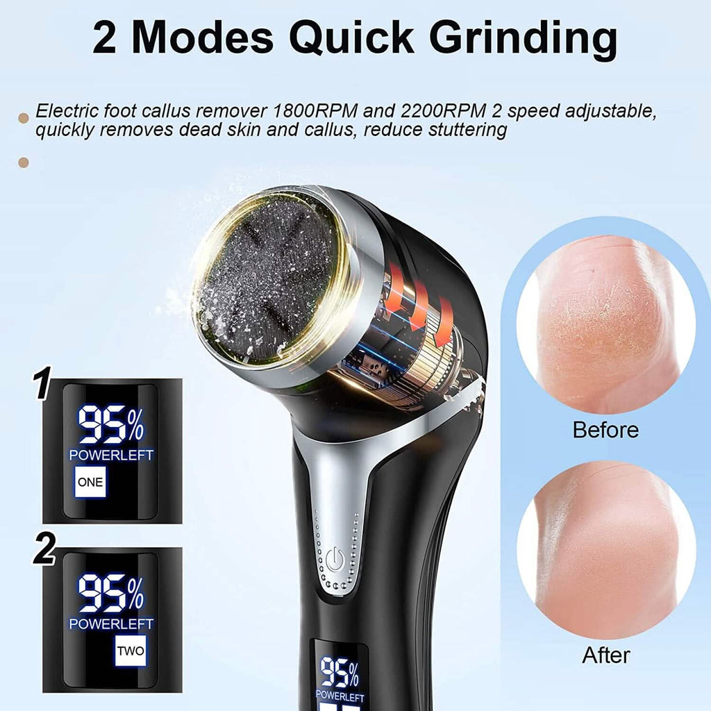 Éliminateur électrique de callosités pour les pieds avec aspirateur