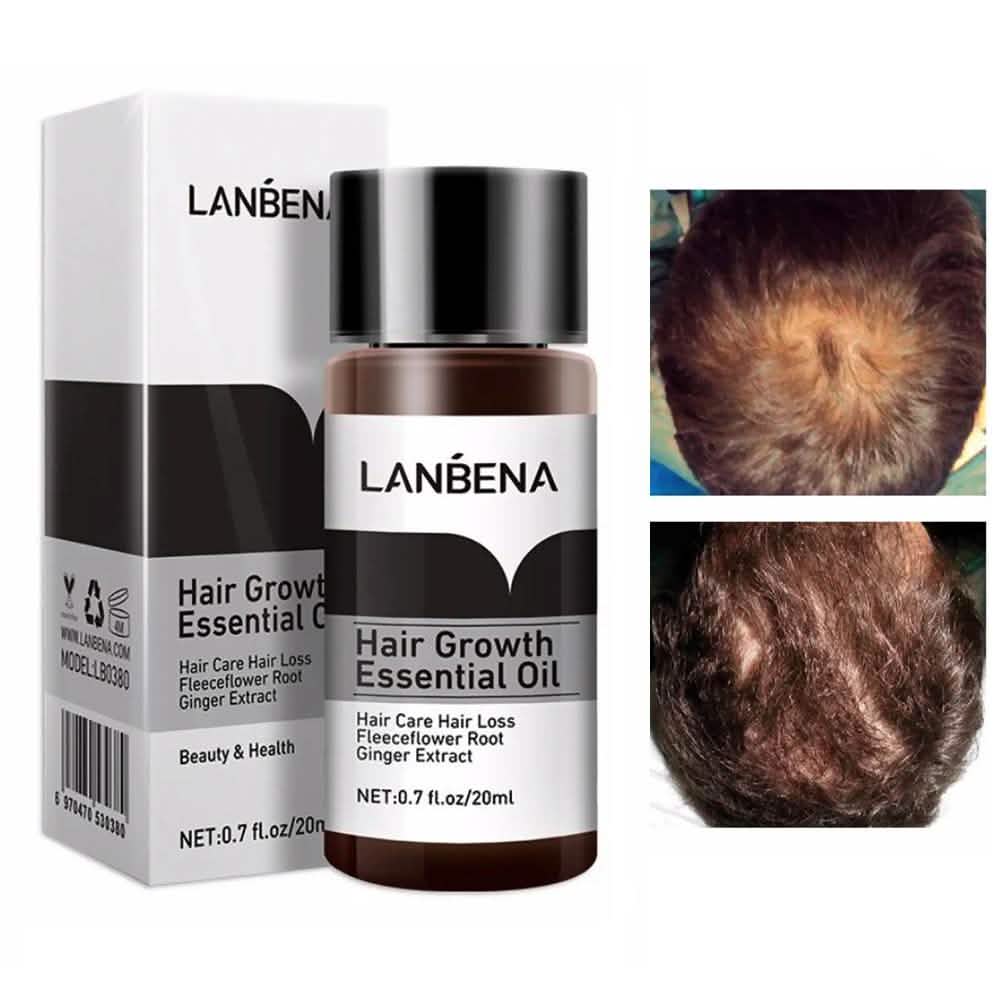 Huile Essentielle Pour la Pousse des Cheveux et Traitement Anti-Chute Pour Hommes et Femmes