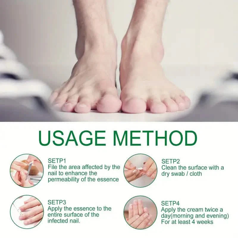Liquide de soin des ongles au gingembre, Réparation des mycoses des ongles, Soin des ongles des mains et des pieds