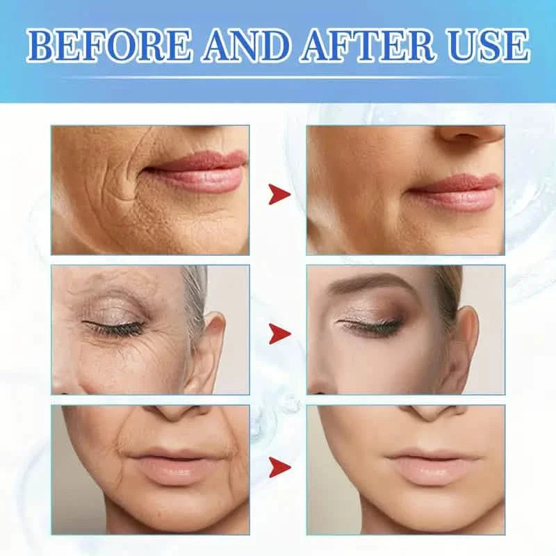 Sérum Intensif Anti-âge à l'Effet Botox - Sérum au Collagène pour la Peau avec Vitamine C, Acide Hyaluronique et Niacinamide